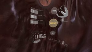 Virtual valve, 3D heart with text and graphic overlay showing systolic pressure, wall thickness, aortic jet velocity