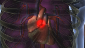 Medical Animation And Illustration of the human heart within the rib cage against a magenta background