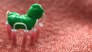 3D Animation still of an internal bodily function