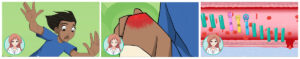 Three stills from a 2D medical animation depicting a boy falling, getting hurt and internal depiction of a medical condition